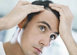Особенности ухода за редеющими волосами